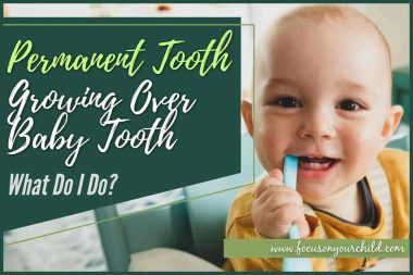 Permanent Tooth Growing Over Baby Tooth – What Do I Do
